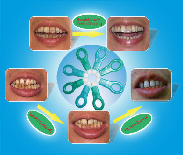 Teeth Whitening Kit - BN Bargains - May 2014 - BellaNaija.com