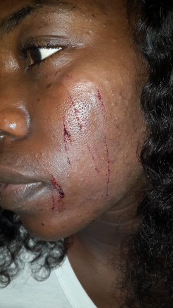 NYSC Corper Brutalized