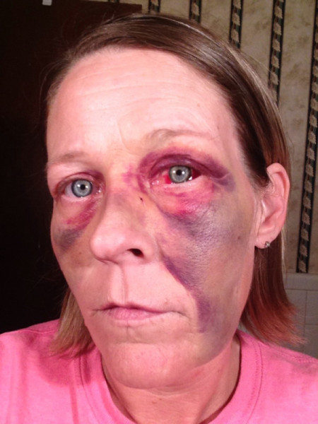 boyfriend bruised face woman abusive angela graphic abused bellanaija brower domestic violence physically ladies being run partner don