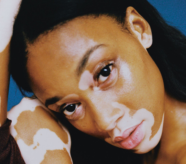 Chantelle Winnie for I-D Magazine by Harry Carr - BellaNaija - November 2014