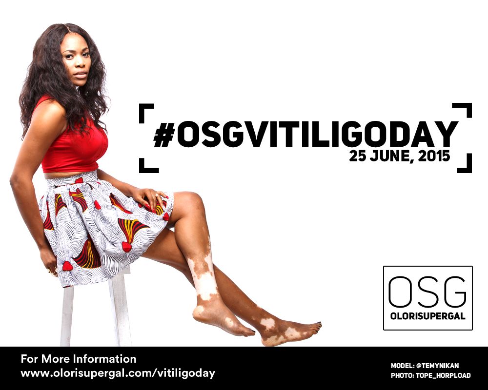 OSGVitiligoDay by Tosin Ajibade of Olori SuperGal - BellaNaija - June2015001 (1)