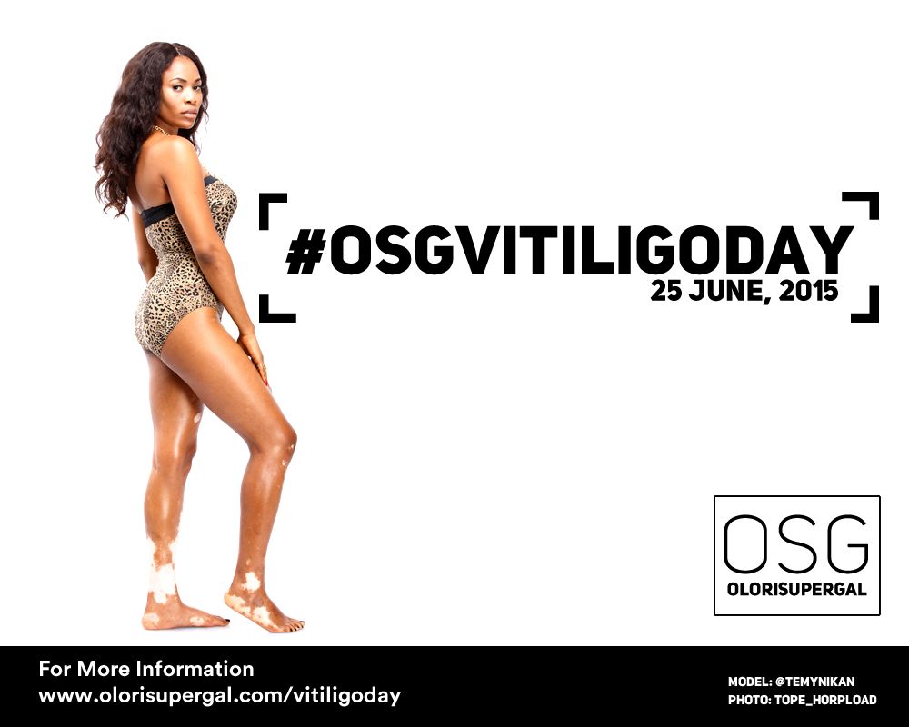 OSGVitiligoDay by Tosin Ajibade of Olori SuperGal - BellaNaija - June2015001 (13)