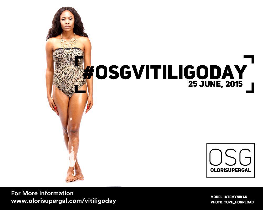 OSGVitiligoDay by Tosin Ajibade of Olori SuperGal - BellaNaija - June2015001 (14)