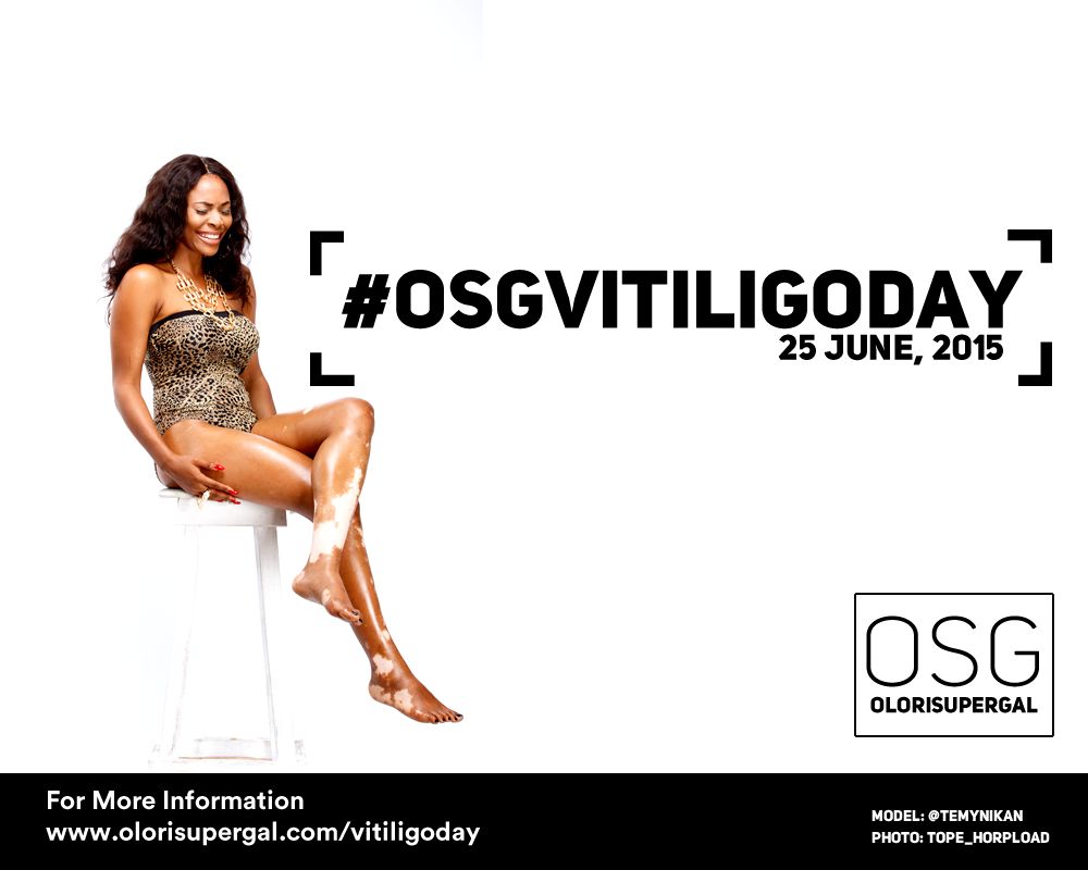 OSGVitiligoDay by Tosin Ajibade of Olori SuperGal - BellaNaija - June2015001 (2)
