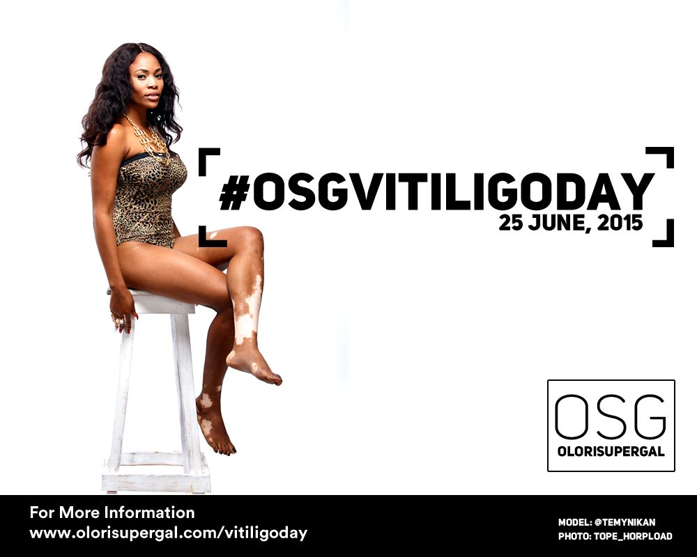 OSGVitiligoDay by Tosin Ajibade of Olori SuperGal - BellaNaija - June2015001 (4)