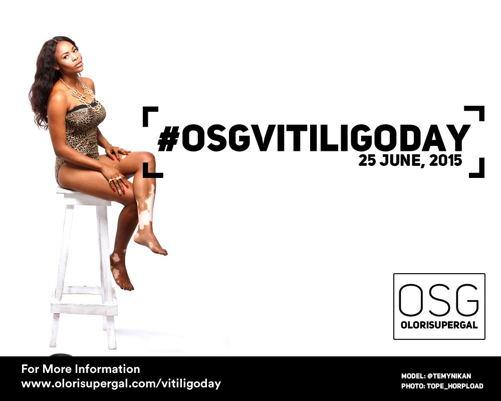 OSGVitiligoDay by Tosin Ajibade of Olori SuperGal - BellaNaija - June2015001 (5)