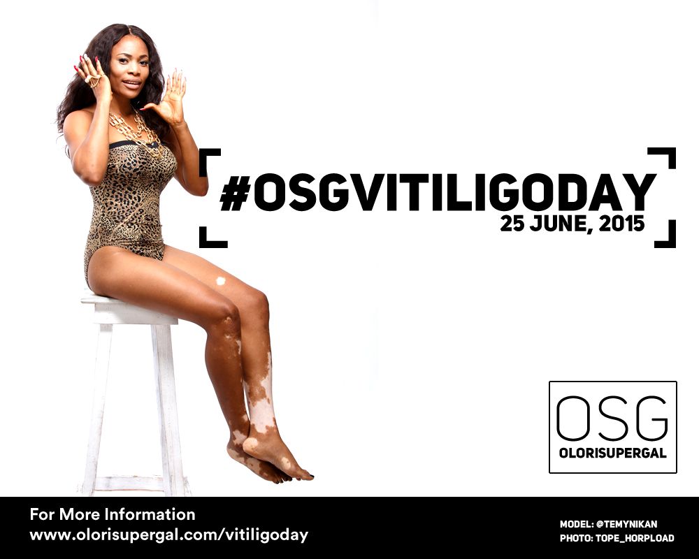 OSGVitiligoDay by Tosin Ajibade of Olori SuperGal - BellaNaija - June2015001 (7)