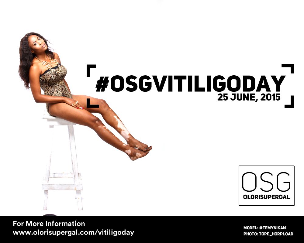 OSGVitiligoDay by Tosin Ajibade of Olori SuperGal - BellaNaija - June2015001 (8)