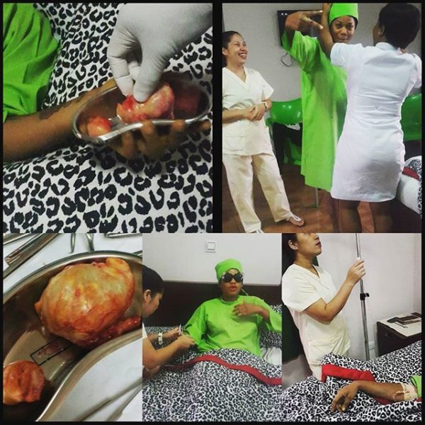 Toyin Lawani Fibroid Surgery 2