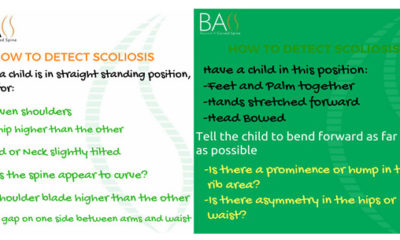 scoliosis