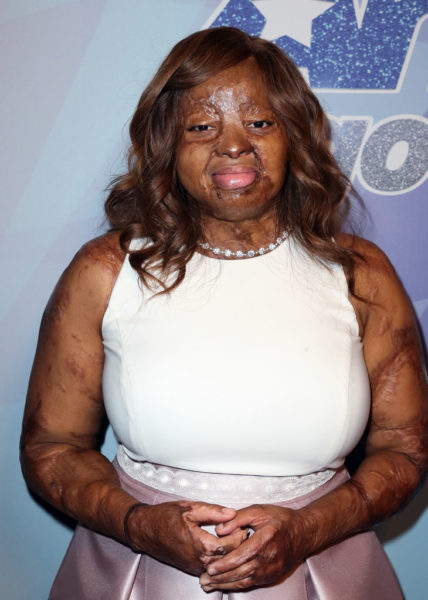 I don't want people to vote for me based on my story - Kechi Okwuchi - BellaNaija