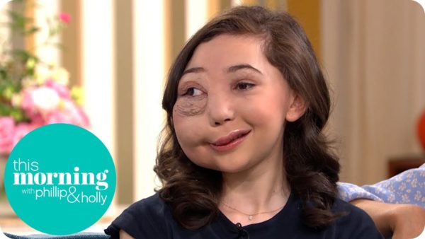 13-Year-Old Vlogger isn't letting a rare deformity stop her from Attaining Success | BellaNaija