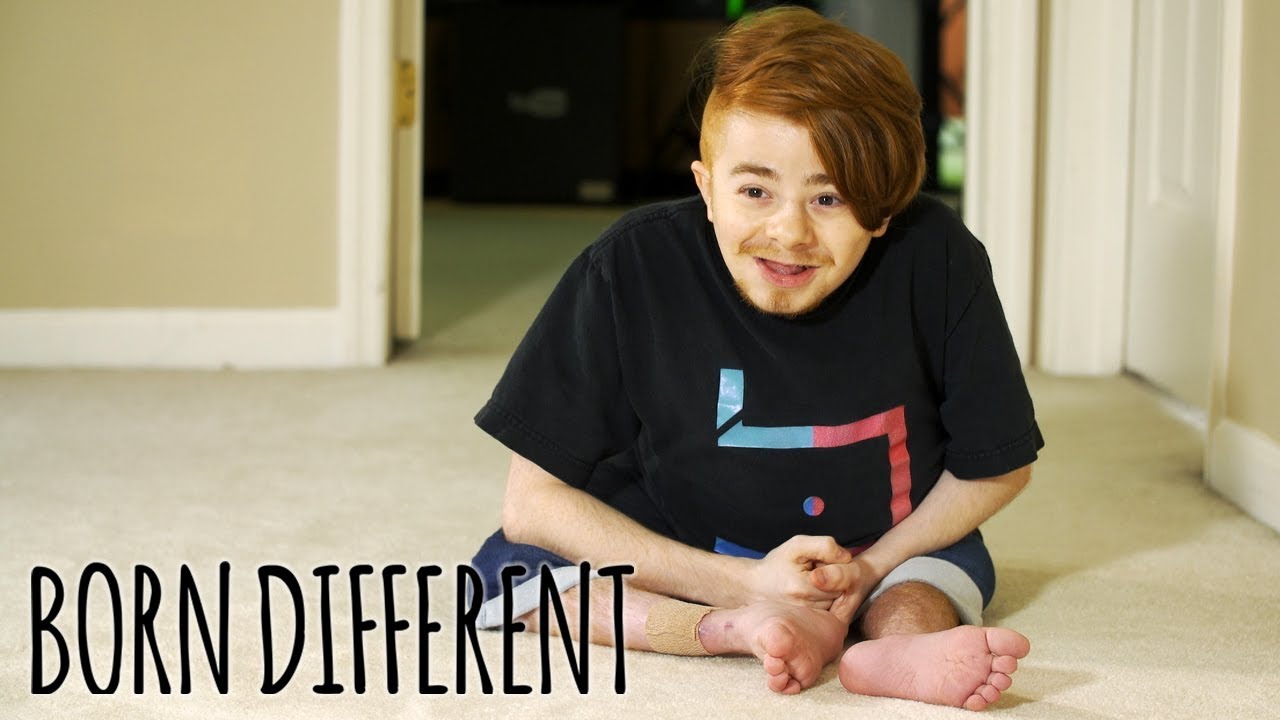 Meet the YouTube Gamer that was "Born Different" This is the