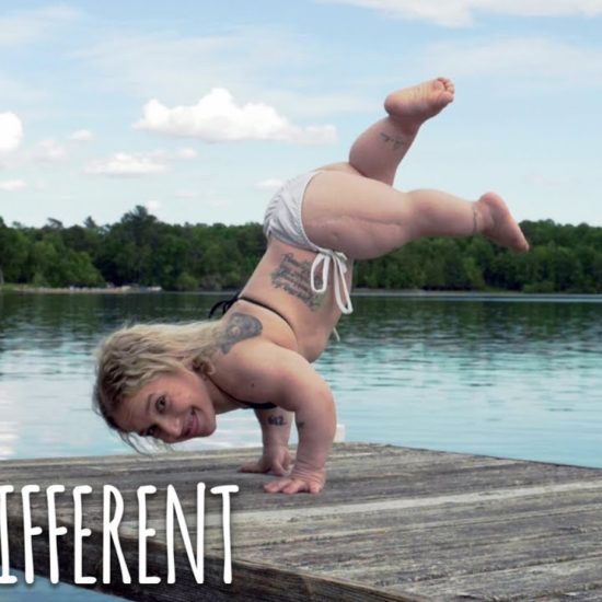 Ann Sarafina's documentary on Neurofibromatosis "Born Differ