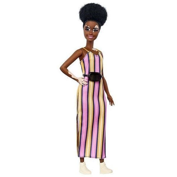 A New Range of Diverse Barbie Dolls includes Dolls with Vitiligo and a