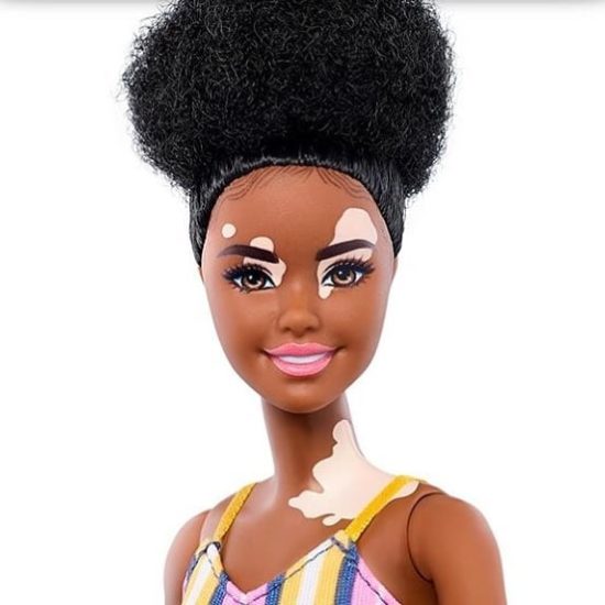 A New Range of Diverse Barbie Dolls includes Dolls with Vitiligo and a