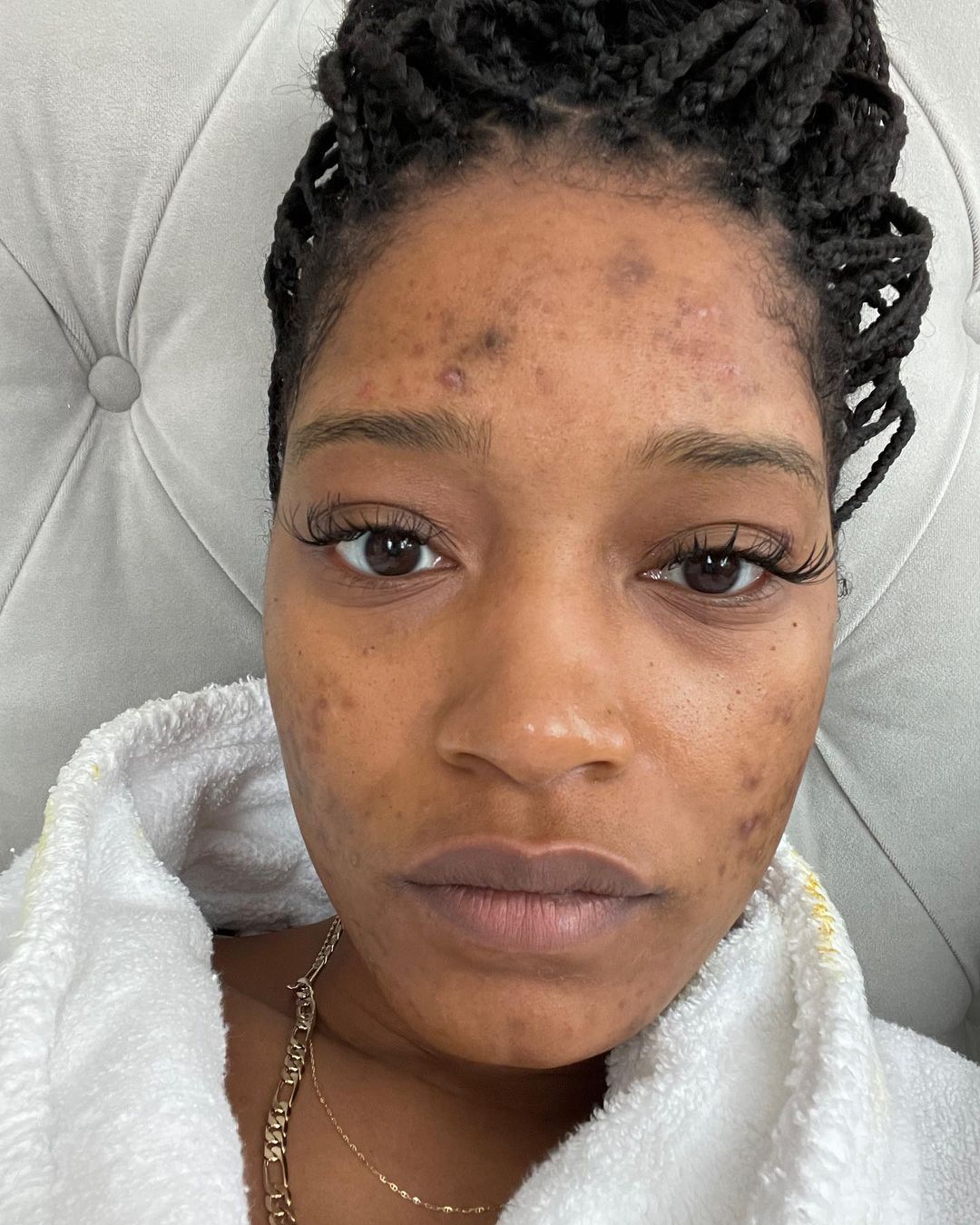 Keke Palmer is Giving a Candid Look at Her experience with PCOS