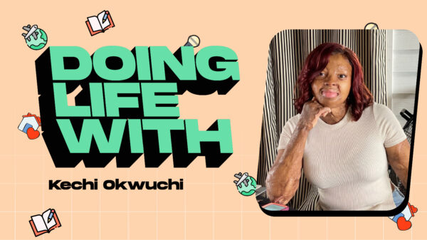 Kechi Okwuchi Discusses Living Beyond Her Scars & Being an Inspiration in Today's "Doing Life With..." - Vimarsana News
