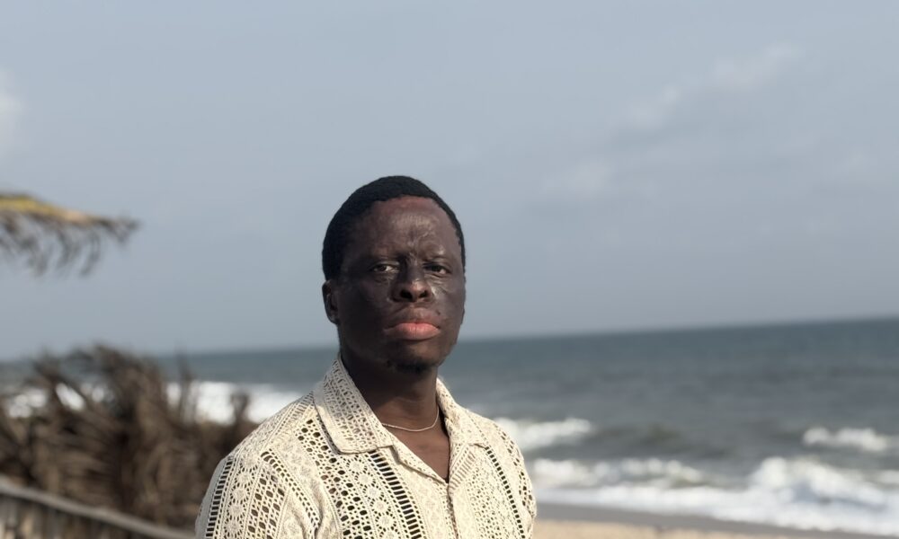 Great Nkor's Miraculous Escape: An Extraordinary Survival Story