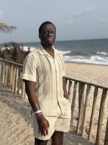 The Extraordinary Story of How Great Nkor Survived a House Fire