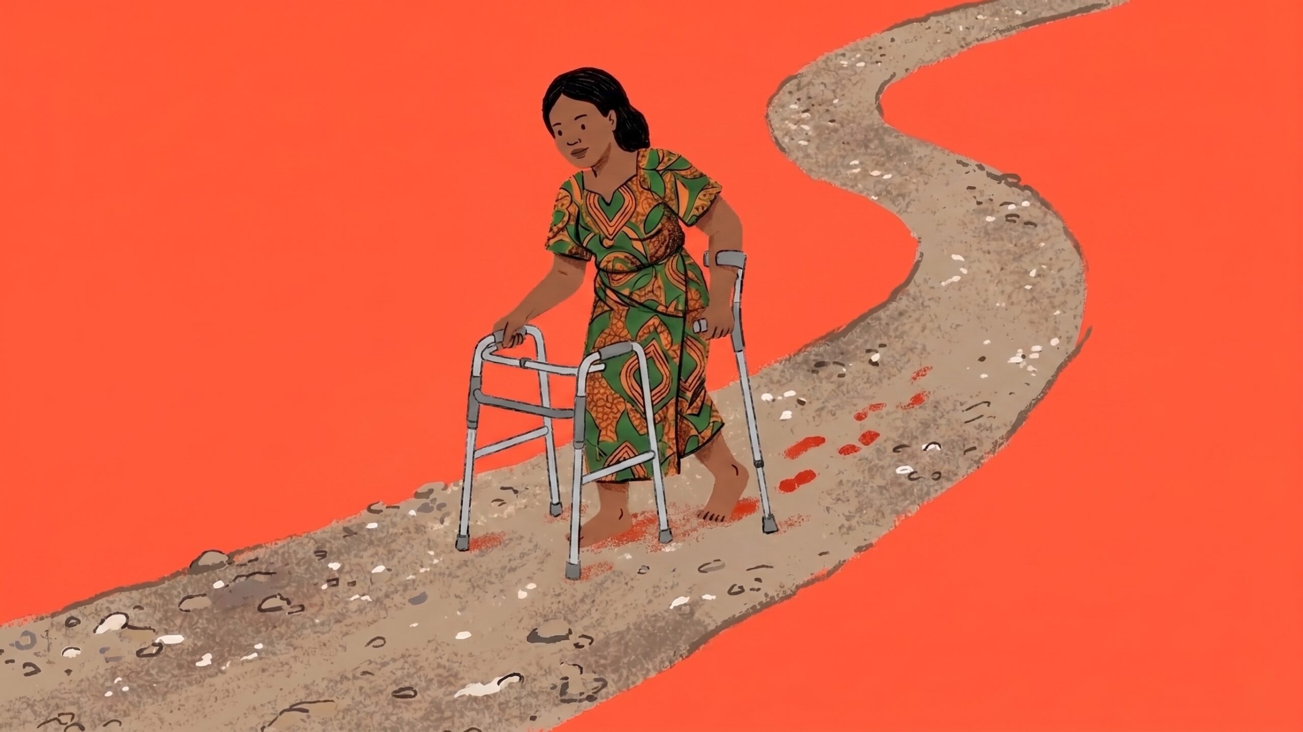 Susan Uko on How She Recovered After Two Total Hip Replacement Surgeries