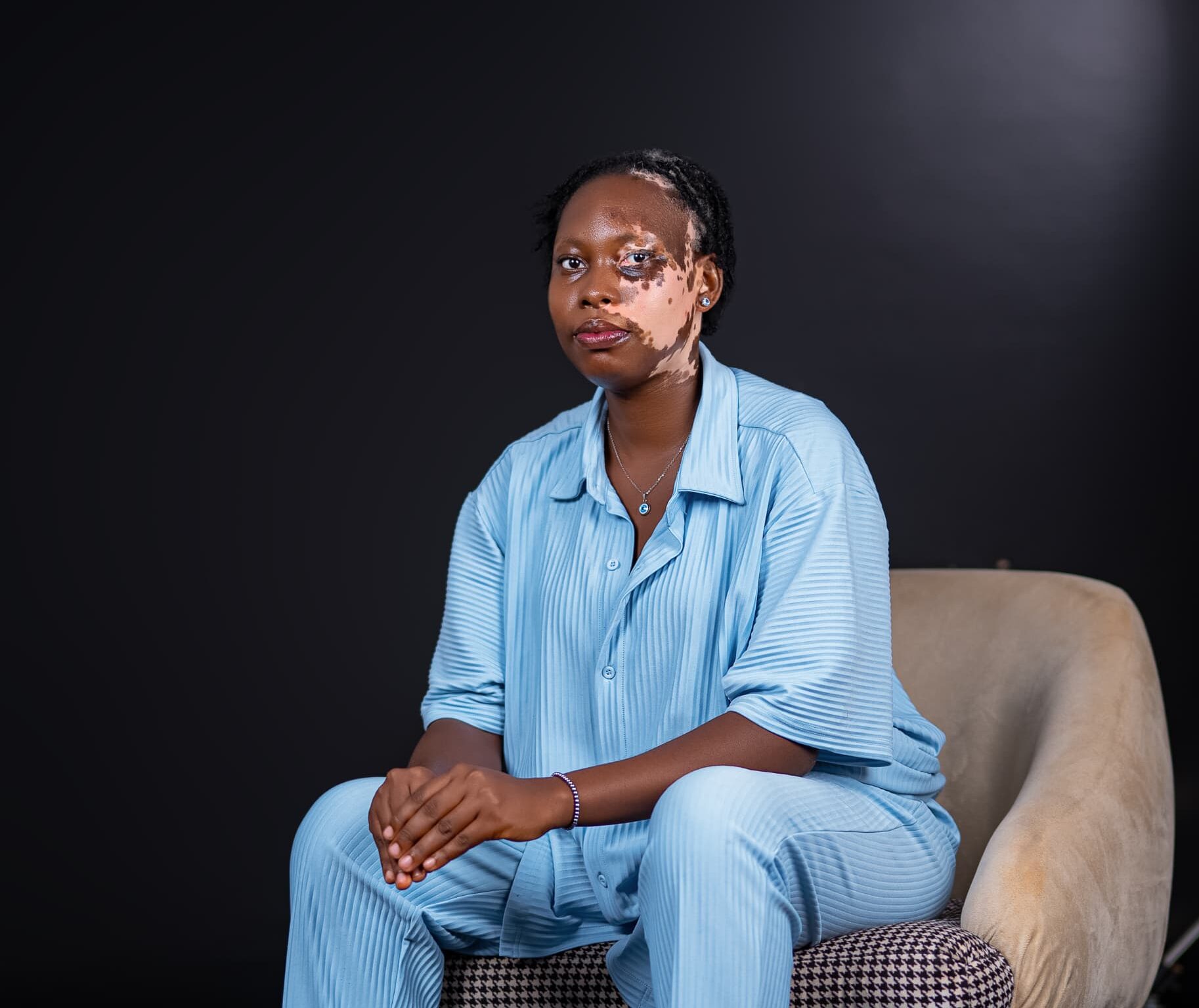 What Living With Vitiligo Has Taught Ruth Akinwole About Confidence